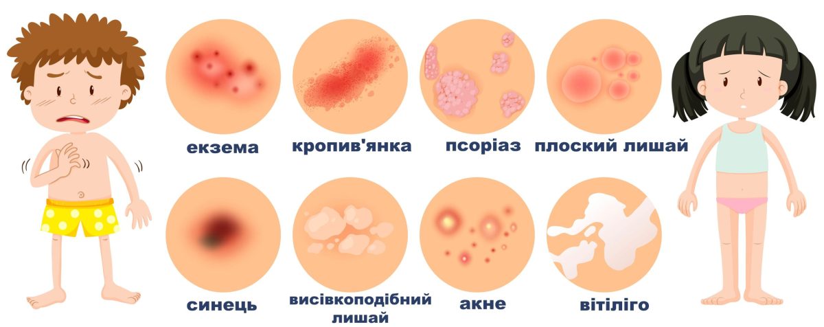 Почервоніння навколо рани: норма чи небезпека?